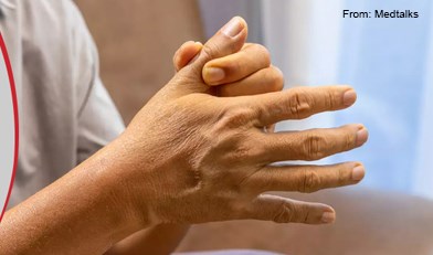 Long COVID Can Damage Joints and Bones