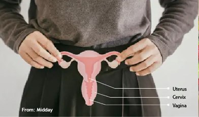 With India's first HPV vaccine set to roll out in 2023, experts hope women finally have a fighting chance against cervical cancer