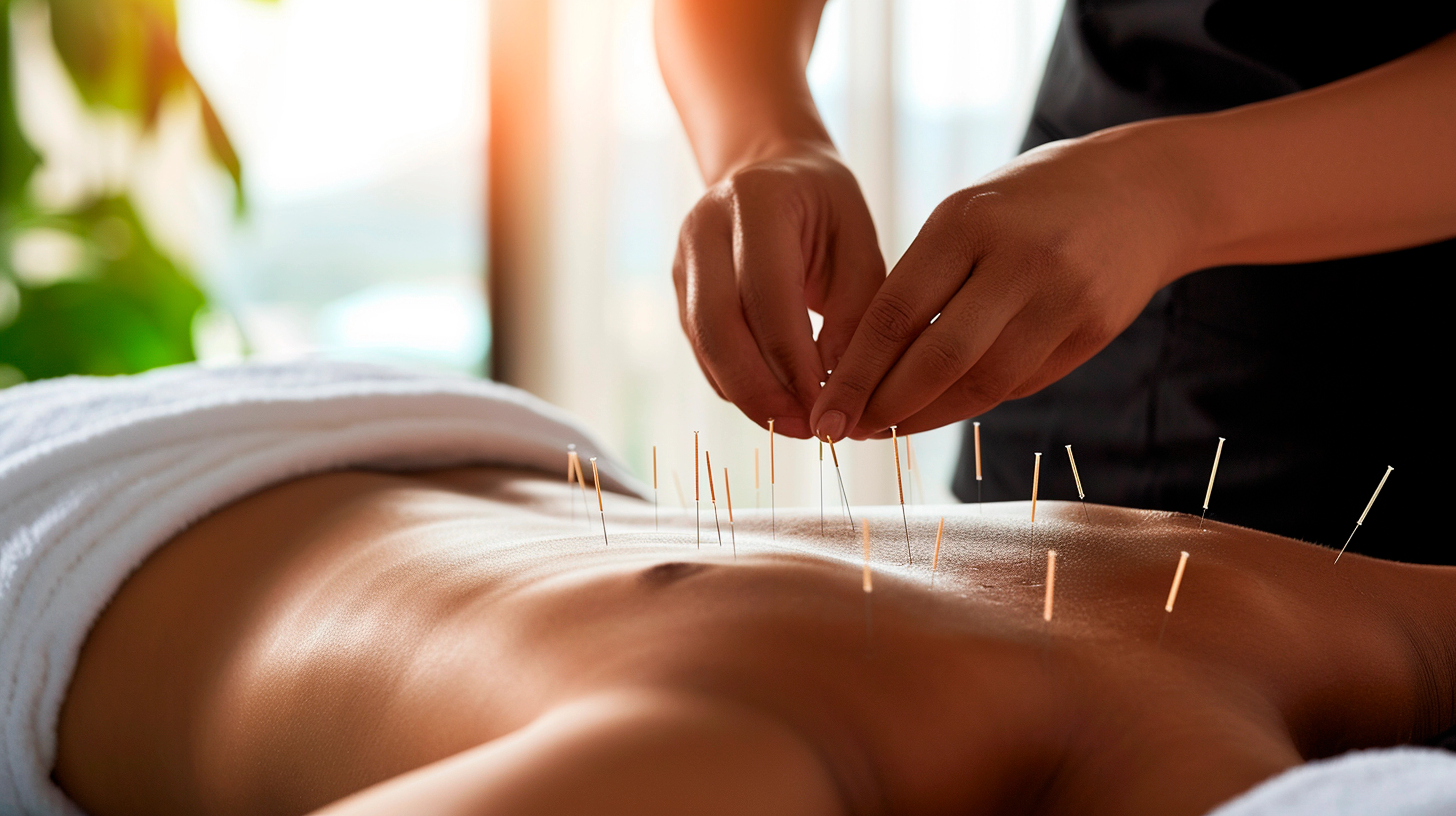 An acupuncture session at the Centre of Wellbeing