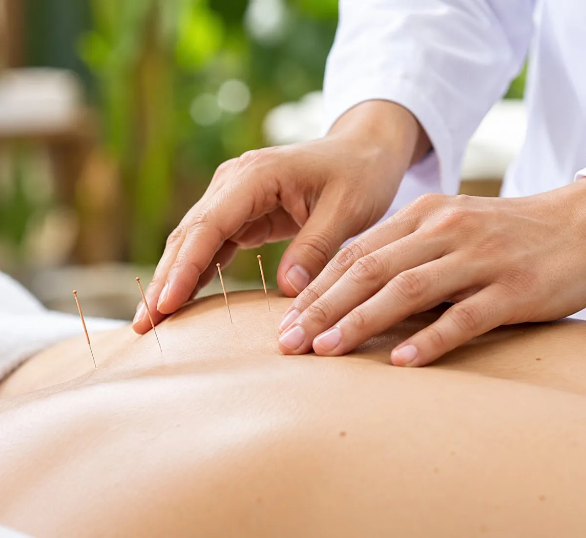 Acupuncture Clinic